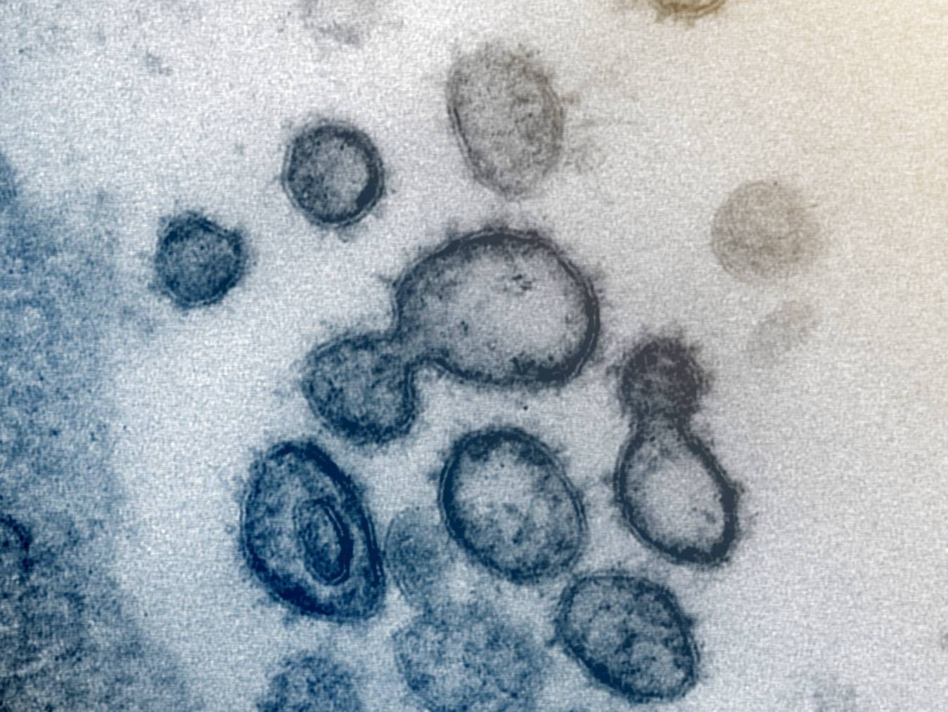 Eine Aufnahme des neuen Coronavirus, aufgenommen in den USA mit einem Elektronenmikroskop.