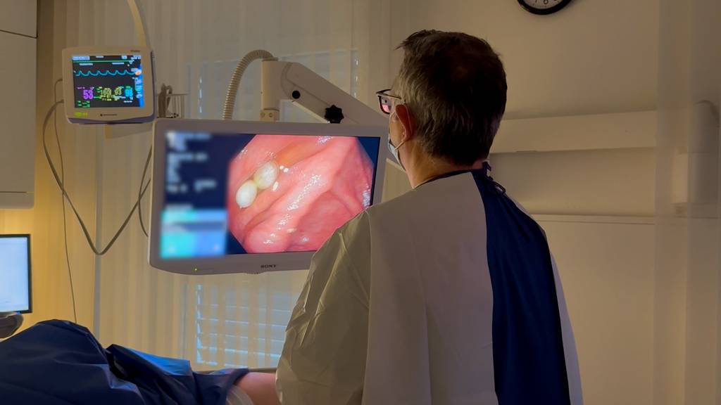 Früherkennung und Prävention von Darmkrebs