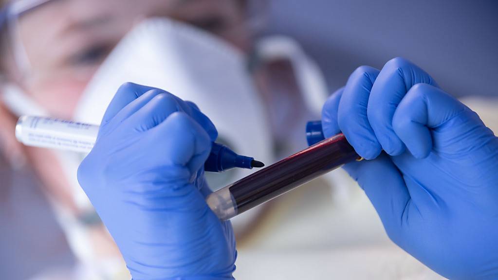 Eine medizinische Mitarbeiterin beschriftet eine Blutprobe für einen Antikörpertest. Ein Forscherteam von der Universität Nantes fand heraus, dass die Blutgruppe einen gewissen Einfluss auf das individuelle Corona-Infektionsrisiko hat.