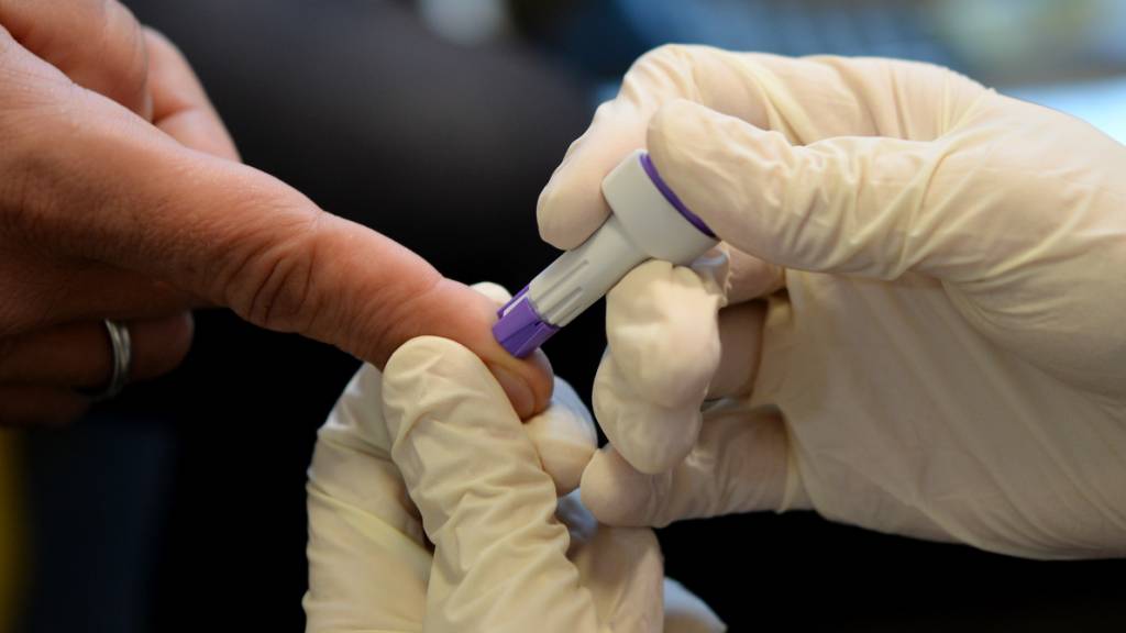 ARCHIV - Ein Arzt nimmt bei der Berliner Aids-Hilfe e.v. an dem Finger eines jungen Mannes Blut ab. In diesem Jahr sind auch angesichts der Corona-Pandemie weniger Menschen zum Testen gegangen. Foto: Britta Pedersen/dpa-Zentralbild/dpa