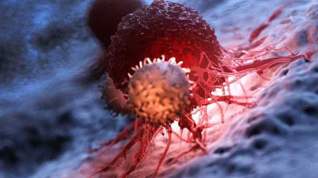 Tumore bestehen aus verschiedenen Zelltypen. Eine Schweizer Studie ist daran, diese im Einzelnen in noch nie dagewesener Detailtreue zu beschreiben. Ziel ist die personalisierte - und deshalb wirksamere - Krebstherapie. Bild: Im Vordergrund eine Immunzelle, rot eine Krebszelle. (Pressebild)