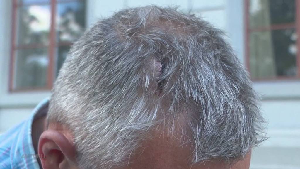 «Wollte schlichten»: SVP-Grossrat erzählt, wie ihn drei Männer in Zofingen verprügelten