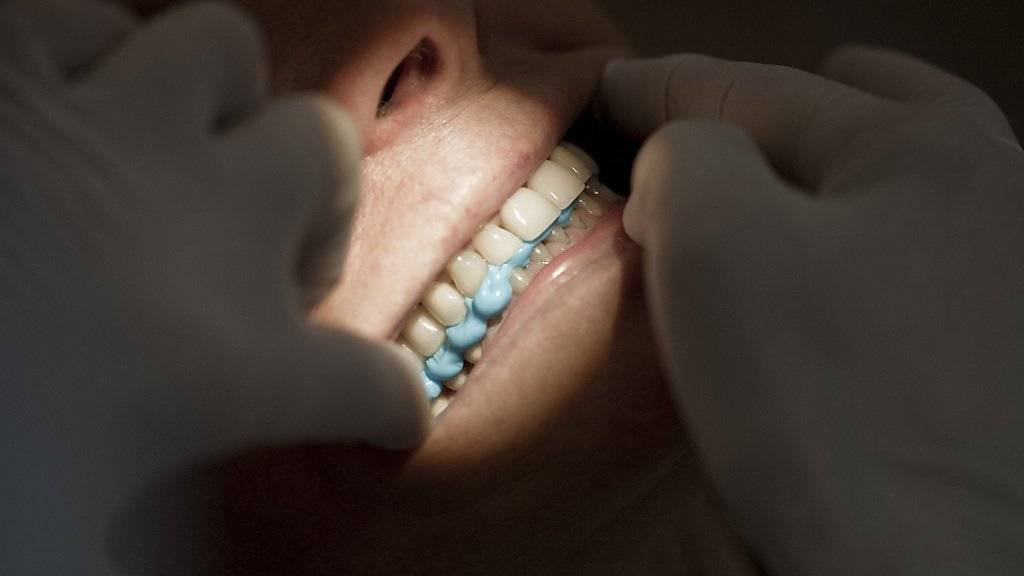 Lieber Schmerzmittel als eine teure Zahnbehandlung: In der Schweiz gehen jährlich Tausende aus Kostengründen nicht zum Zahnarzt. (Archivbild)