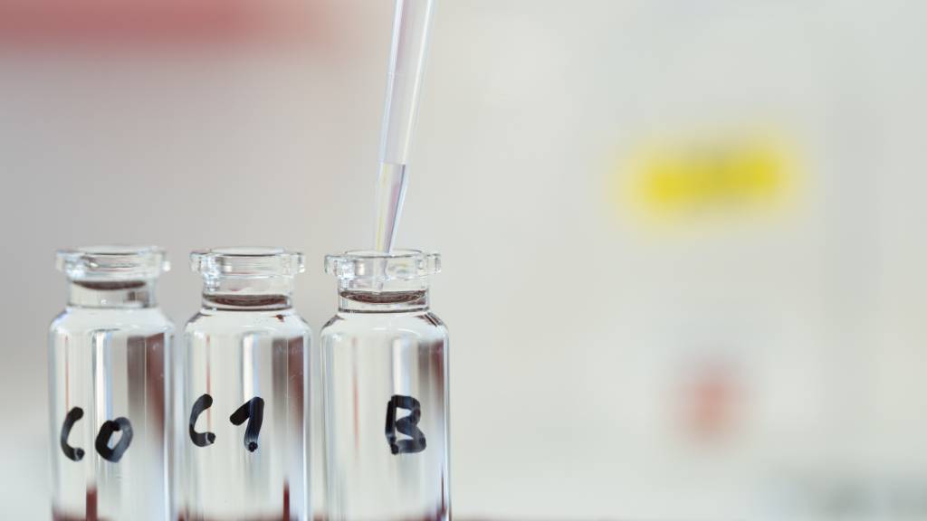 Wird zu sehr nach PFAS-Rückständen gesucht? Die bürgerlichen Fraktionen wollen weniger Tests durch das Amt für Umwelt. (Archivbild)