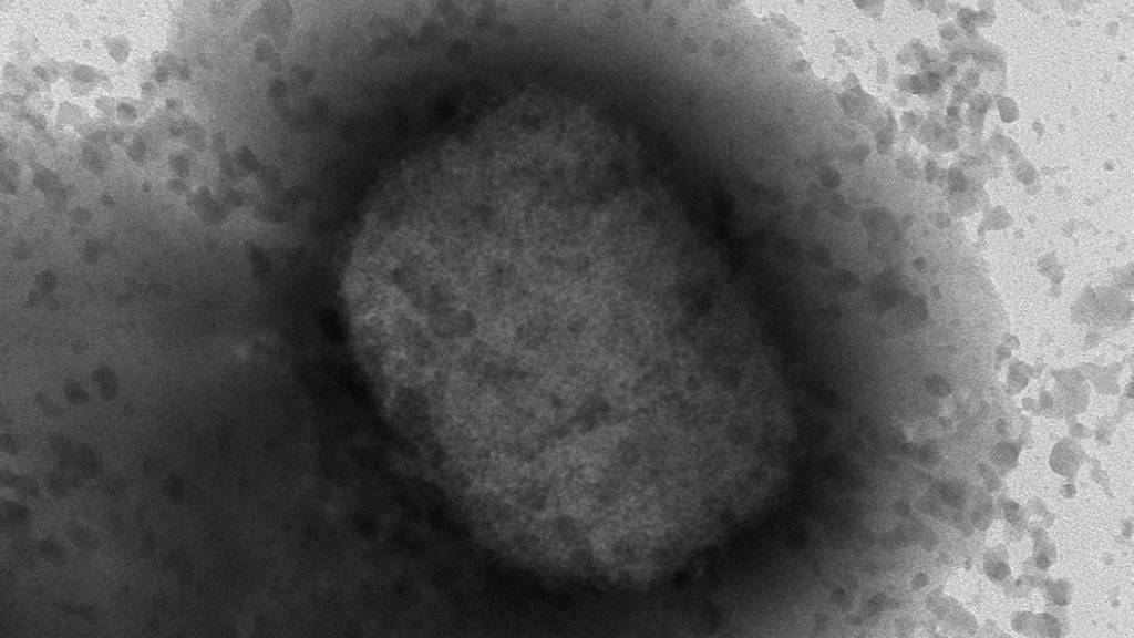 Eine elektronische Mikroskope-Aufnahme des Affenpocken-Virus. (Archivbild)