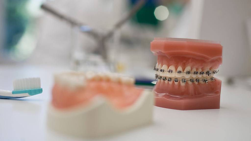 Demonstrationsobjekte in einer Zahnarztpraxis: Zahnbehandlungen können das Familienbudget belasten. (Symbolbild)
