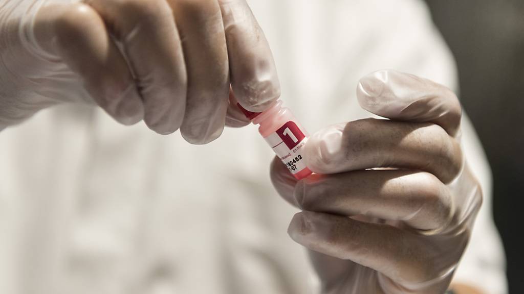 Aids-Test in einer Apotheke: Der Bundesrat will mit einem neuen nationalen Programm erreichen, dass es bis 2030 keine Ansteckungen mehr gibt mit dem HI-Virus sowie mit Hepatitis B und C. (Themenbild)