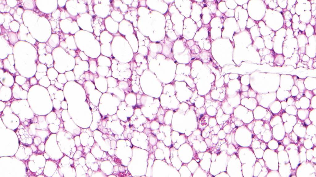 ETH-Forschende entdecken Abnehm-Zellen mit Sisyphos-Mechanismus