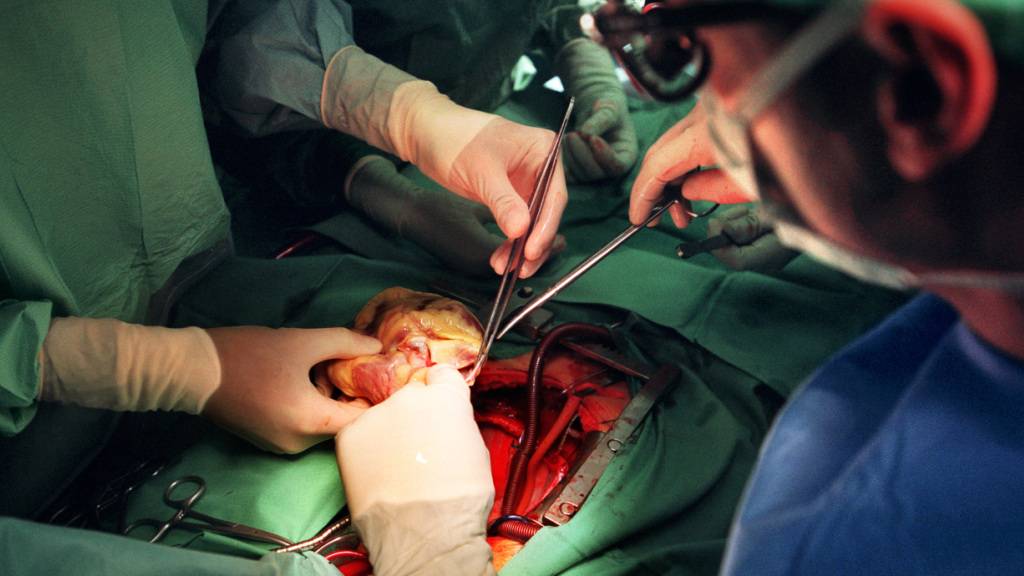 Implantation eines Spenderherzens im Inselspital in Bern. (Archivbild)