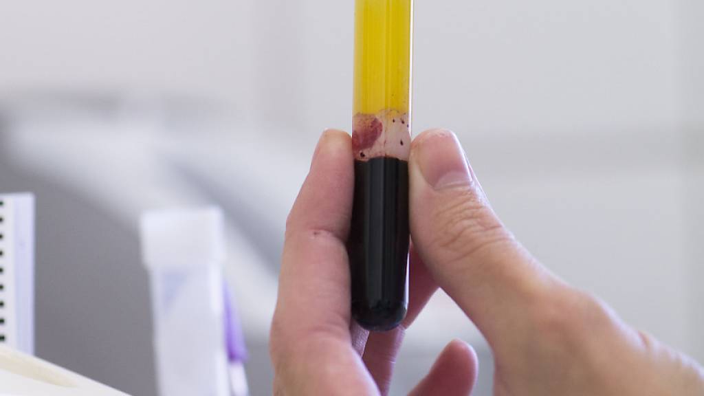 Biomarker im Blut erlaubt Prognose bei Multipler Sklerose