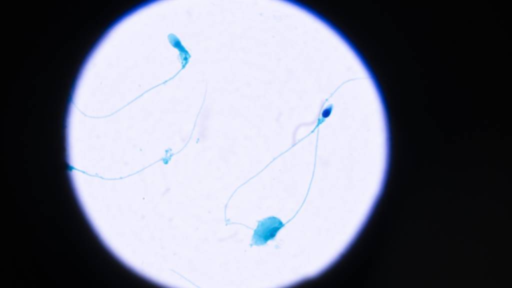 Bei der Befruchtung klammern sich Spermien und Eizellen mit einer speziellen Verbindung aneinander fest. (Archivbild)