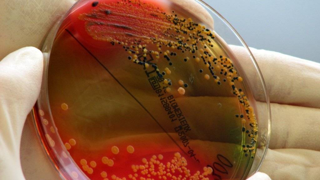 Immer mehr Bakterien lassen sich nicht mehr mit Antibiotika bekämpfen. Tausende Menschen sterben jedes Jahr an den Infektionen. (Archivbild)