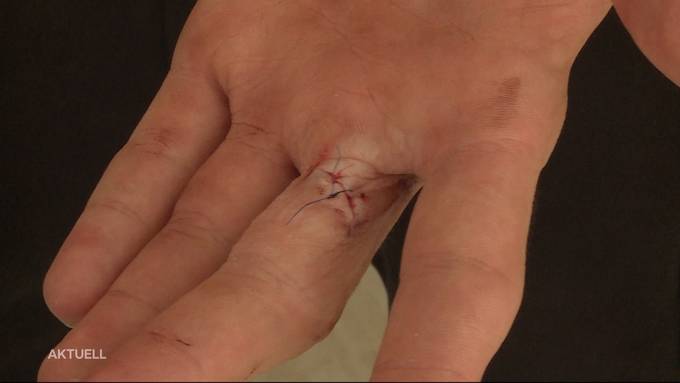 15-Jähriger in Schöftland von zwei Jugendlichen mit Messer verletzt