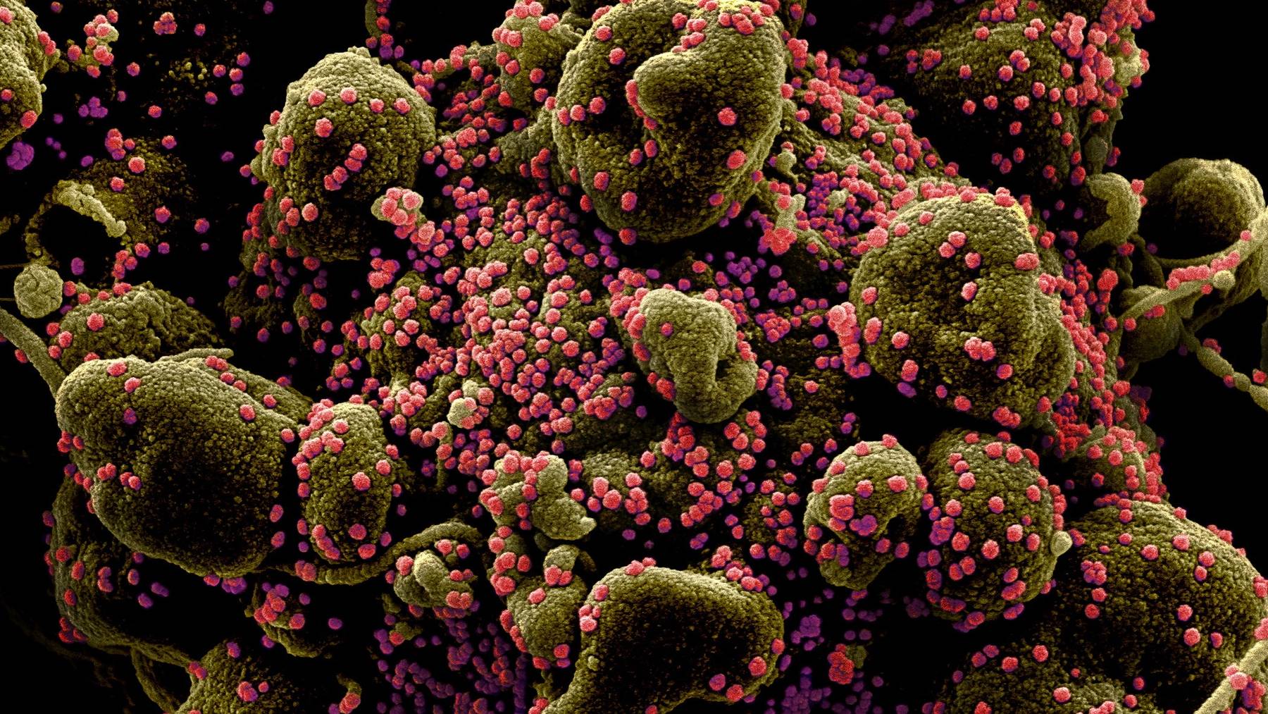 Erste jede 25. Person hat sich in der Schweiz mit dem Coronavirus angesteckt. (Symbolbild)