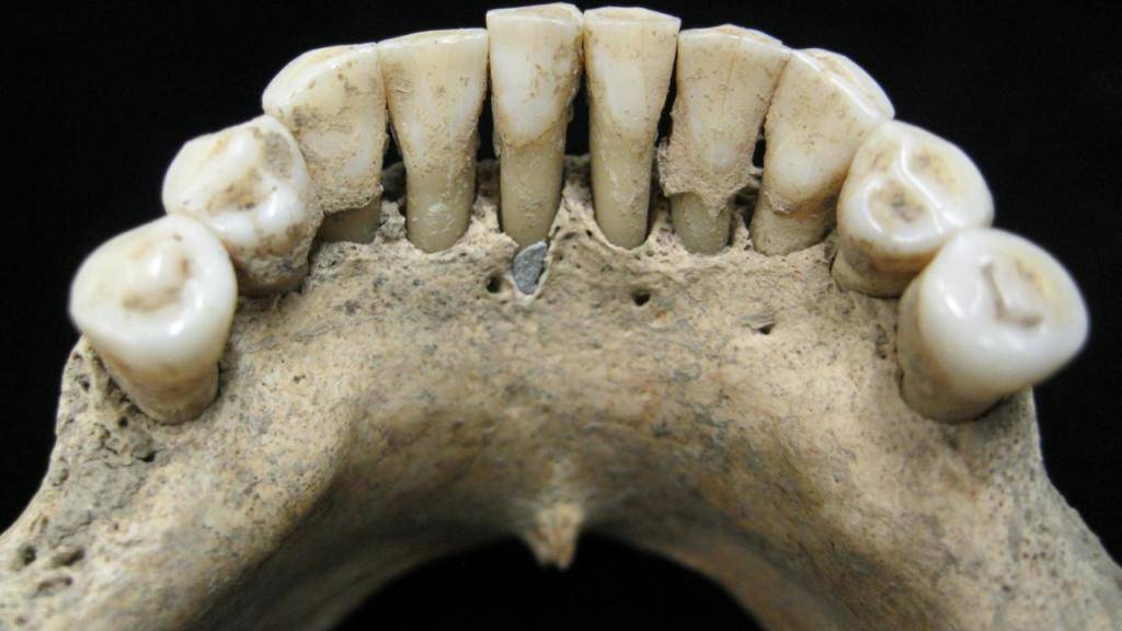 Der Zahnstein einer Frau aus dem Mittelalter verrät, dass sie mit dem wertvollen Farbpigment Ultramarin gearbeitet hat.
