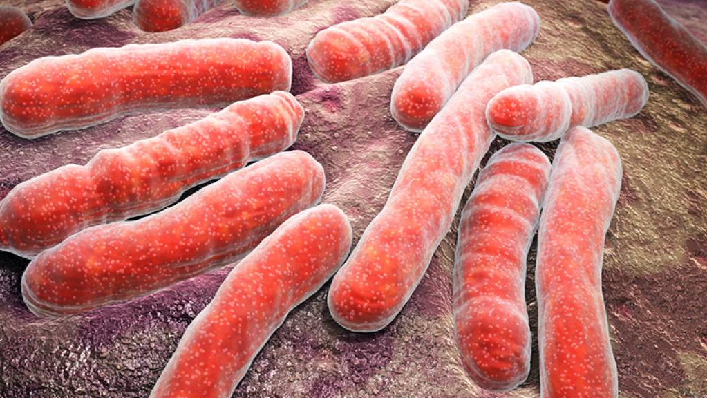 Mycobacterium tuberculosis, der Auslöser der meisten Tuberkulose-Fälle. Forscher der Uni Zürich haben Vorarbeiten für ein Medikament abgeschlossen, welches die immer häufiger gegen Antibiotika resistenten Bazillen verhungern lässt, indem es die Eisenzufuhr kappt. (Pressebild)