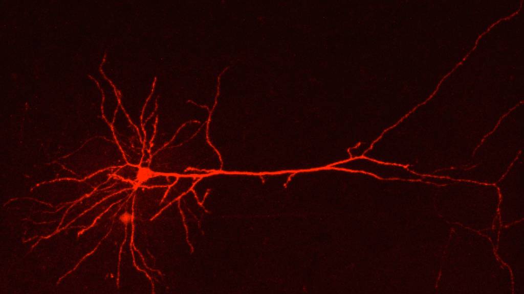 Morphologische Rekonstruktion eines Neurons des cingulären Kortex bei Migräne. Durch genetische Veränderung des «Bösewichts», des mutierten Astrozyten, konnten Forscher der Uni Zürich bei Mäusen das Kopfweh reduzieren. Etwa 15 Prozent der Menschheit - alles Migräne-Opfer - hoffen nun.  (UZH)