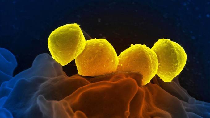 Empa-Forscher entwickeln Wundverband, der Bakterien abtötet