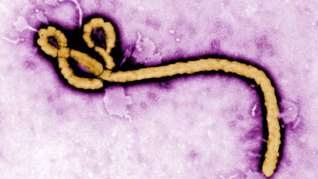 ARCHIV - Datum und Ort unbekannt: Die Aufnahme eines Elektronenmikroskops zeigt ein einzelnes Viruspartikel des Ebola-Virus. Foto: Frederick Murphy/CDC/AP/dpa