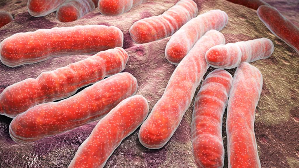Mycobacterium tuberculosis, der Auslöser der meisten Tuberkulose-Fälle. Forscher der Uni Zürich haben Vorarbeiten für ein Medikament abgeschlossen, welches die immer häufiger gegen Antibiotika resistenten Bazillen verhungern lässt, indem es die Eisenzufuhr kappt. (Pressebild)