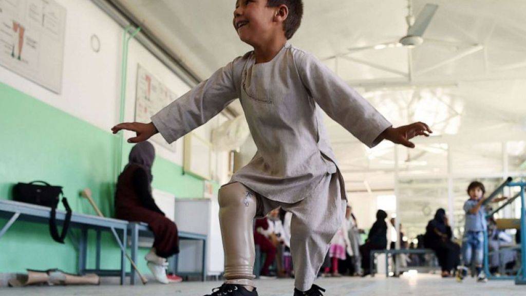 Das grosse Glück des fünfjährigen Ahmad Rahman: In der orthopädischen Klinik des Roten Kreuzes in Kabul tanzt er breit grinsend und freut sich über seine Beinprothese.