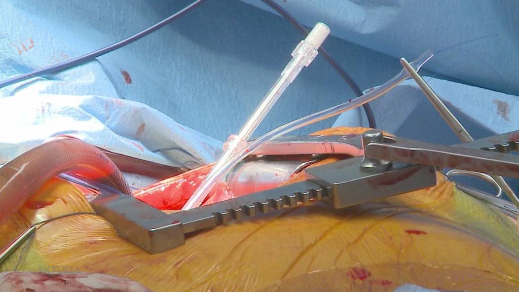 Ja zu Efas: Das Volk stimmt der Gesundheitsreform klar zu