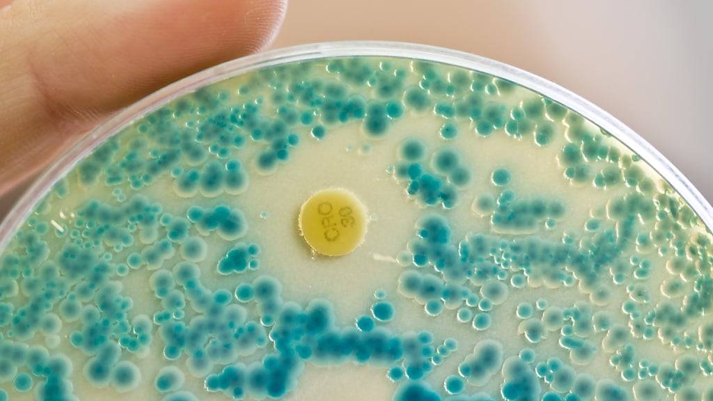 KI kann helfen antibiotikaresistente Bakterien zu erkennen