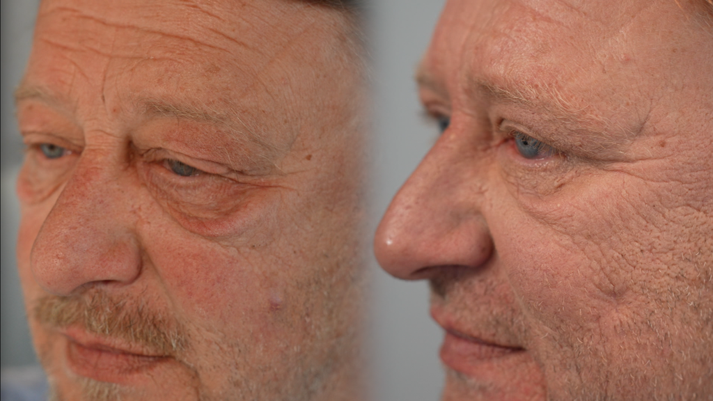 Skinmed Vorher Nachher
