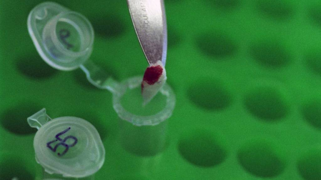 Der Kanton Schwyz setzt bei möglichen Rissereignissen auf DNA-Proben. (Symbolbild)