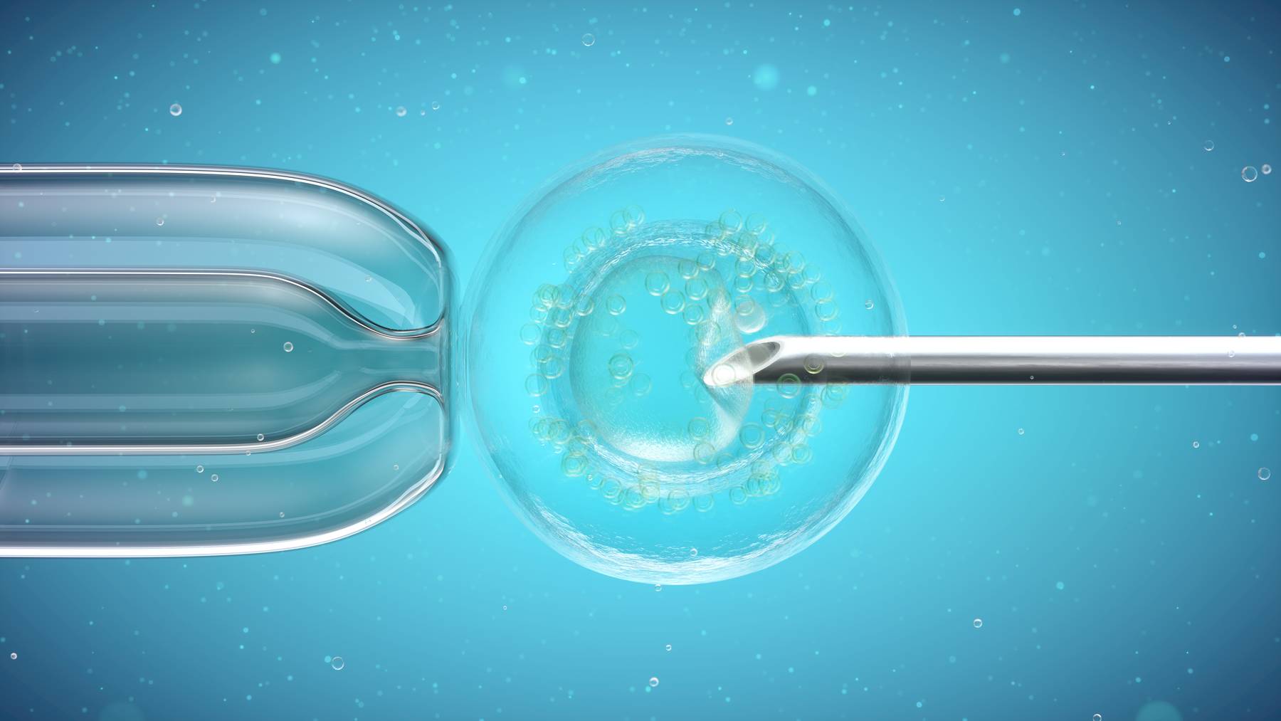Bei einer In-Vitro-Fertilisation befruchten die Samenzellen in einer Glasschale die Eizellen. Danach werden der Frau bis zu drei Embryos wieder in die Gebärmutter eingesetzt.