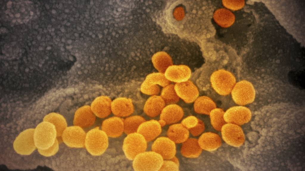 Eine elektronenmikroskopische Aufnahme des «U.S. National Institute of Health» zeigt das neuartige Coronavirus (SARS-CoV-2), das aus der Oberfläche von im Labor kultivierten Zellen austritt. Foto: NIAID-RML/AP/dpa 