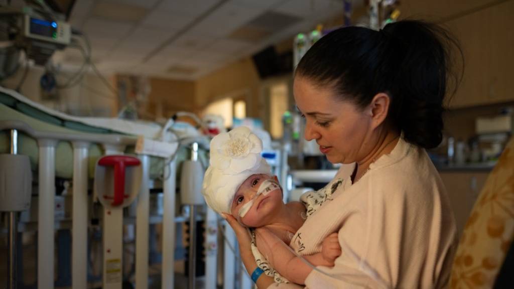 In diesem vom UC Davis Children's Hospital zur Verfügung gestelltem Handout zeigt Mutter Liliya ihr Kind Micaela nach der Operation.