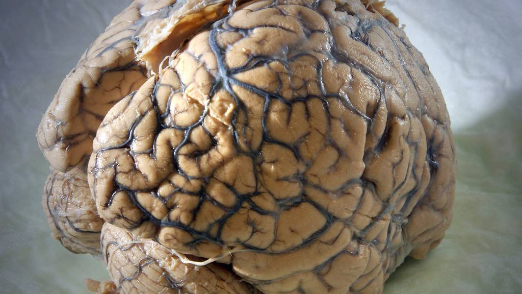 Forscherteams haben zusammen den bislang umfangreichsten Zellatlas des menschlichen Gehirns erstellt.
