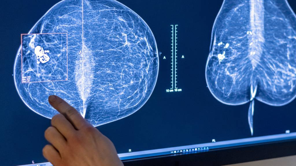 Kleine Genvarianten können Antikörpertherapien unwirksam machen