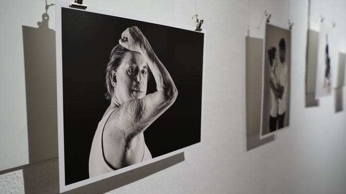 Narben und Falten im Fokus – Nidwaldnerin fotografiert gegen den Schönheitswahn
