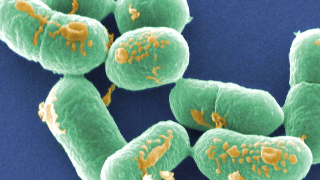 Eine schwere Infektion durch Listerienbakterien kann bis zum Tod führen (Symbolbild)