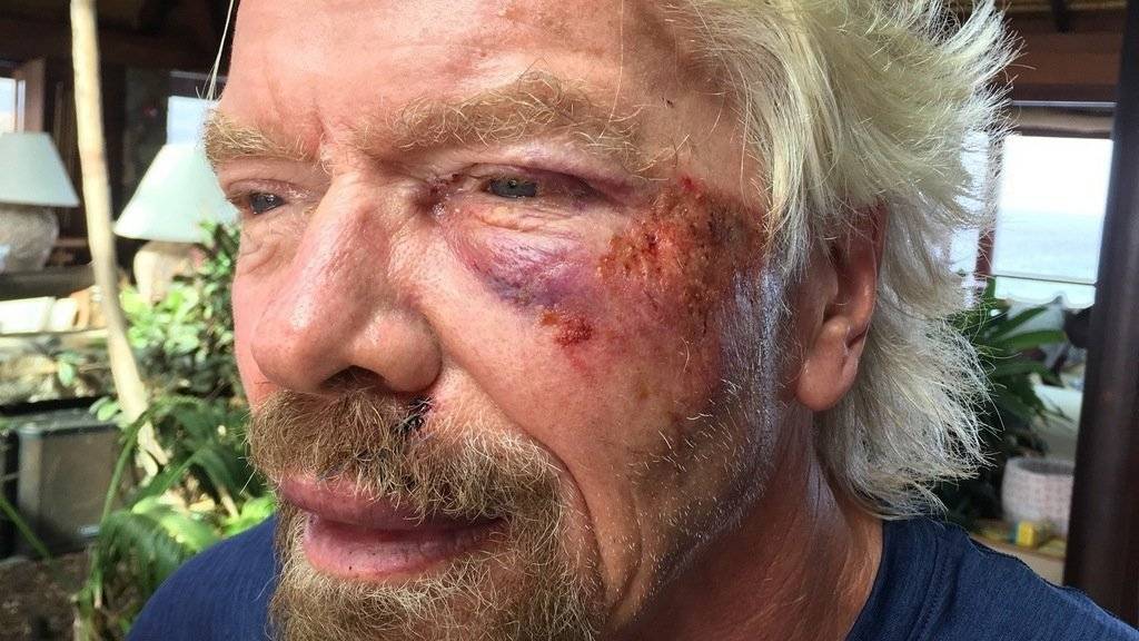 Der britische Milliardär und Unternehmer Sir Richard Branson ist vom Fahrrad gestürzt und hat sich verletzt (Archiv)