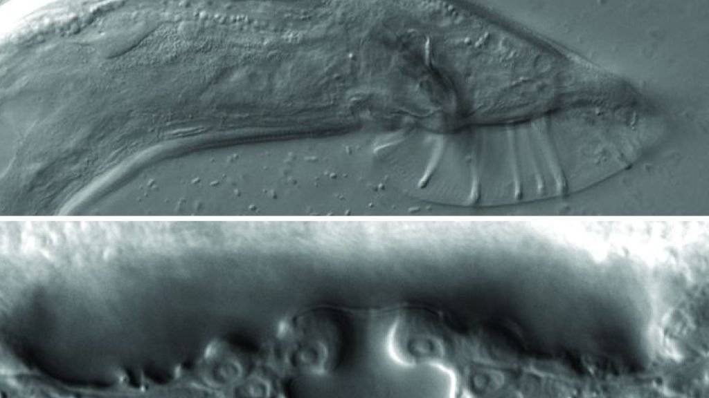 Die primären Geschlechtsorgane des Fadenwurms Caenorhabditis elegans, oben das männliche, unten das weibliche. Die Entschlüsselung des Geschlechtsreifungsprozesses von C. elegans soll laut Basler Forschern auch Rückschlüsse auf die menschliche Pubertät erlauben. (zVg)